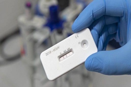 A scientist presents an antibody test to use with a blood sample for the coronavirus at a laboratory. (Photo: AP)