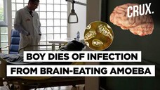 What Is The &lsquo;Brain-Eating Amoeba&rsquo; Reported In Texas?