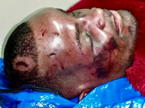 EDS NOTE: GRAPHIC CONTENT - This undated photo provided by the family of Ronald Greene via the Baton Rouge chapter of the NAACP in September 2020 shows injuries on his body. Greene's family filed a federal wrongful death lawsuit in May 2020 alleging troopers 