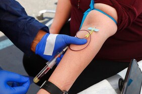 Large Antibody Study Offers Hope For Virus Vaccine Efforts