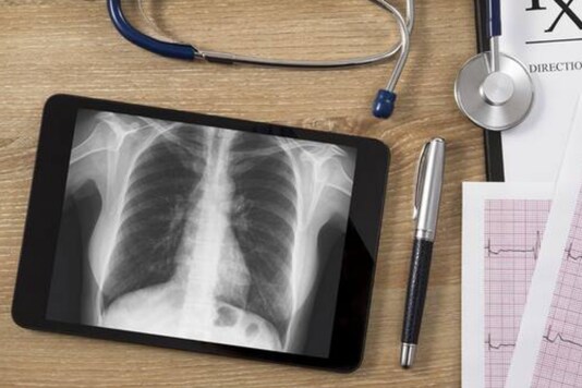 Image for representation. (Photo courtesy: AFP Relaxnews/ anilakkus/ Istock.com)
