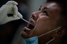 Is Sore Throat a Confirmed Symptom of Coronavirus Infection?