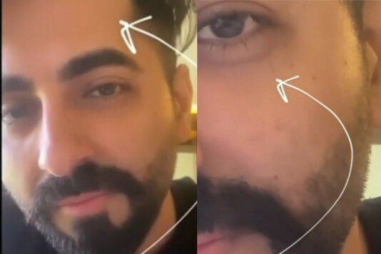 ayushmann-khurrana-wonders-what-to-wish-on-his-broken-eyelash-says-he-got-what-he-wanted