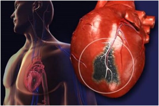 preventive cardiology