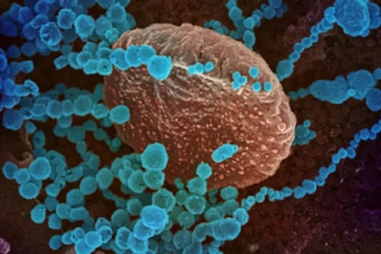 Chapare Virus: All You Need to Know About the Rare Ebola-like Virus Chapare Virus: All You Need to Know About the Rare Ebola-like Virus