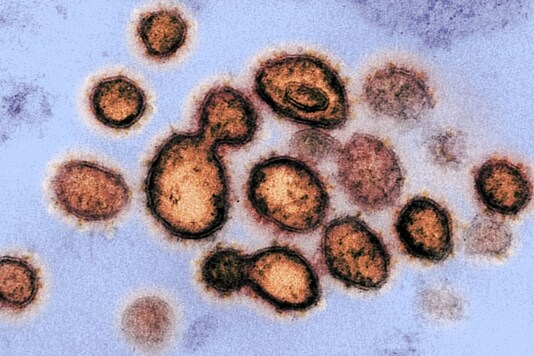 Image credits: National Institutes of Health/AFP.