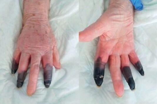 Image via European Journal of Vascular and Endovascular Surgery.