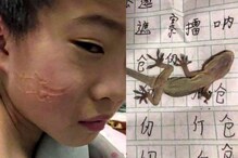 Boy Dozes off on Lizard While Doing Homework, Wakes up With Reptile Impression on His Face