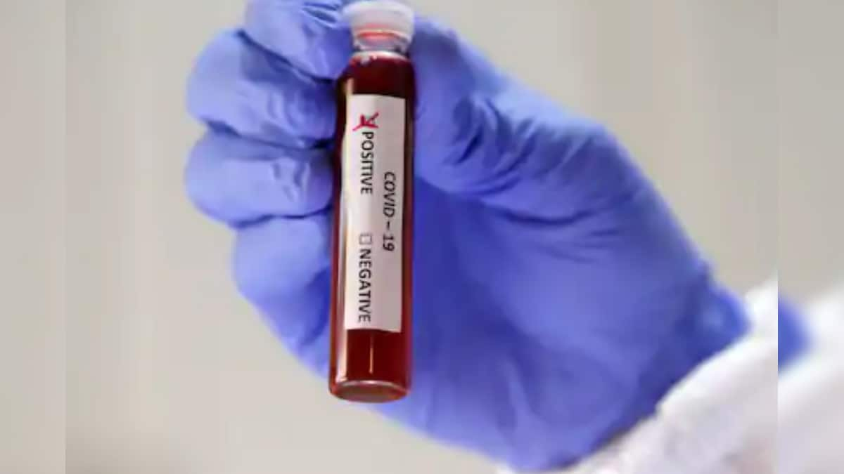 Blood Tests Can Offer Early Indicator of Severe Covid-19 in Patients: Study