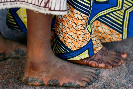 The feet of girls who were kidnapped from a boarding school in the northwest Nigerian state of Zamfara are seen after their release in Zamfara, Nigeria March 2, 2021. (REUTERS/Afolabi Sotunde)
