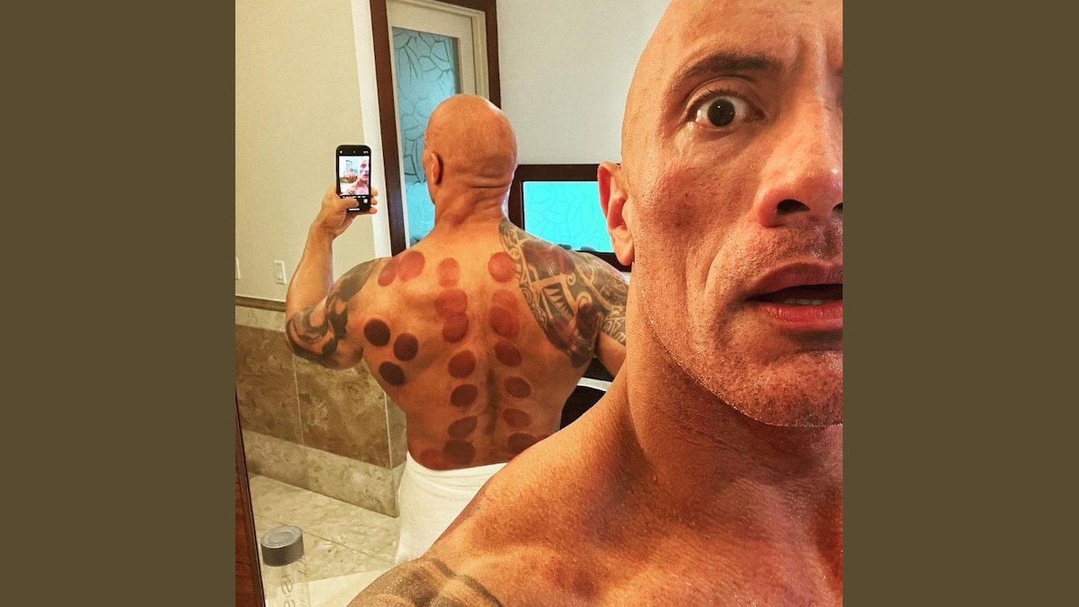 Dwayne ‘The Rock’ Johnson Just Discovered This Chinese Therapy and is