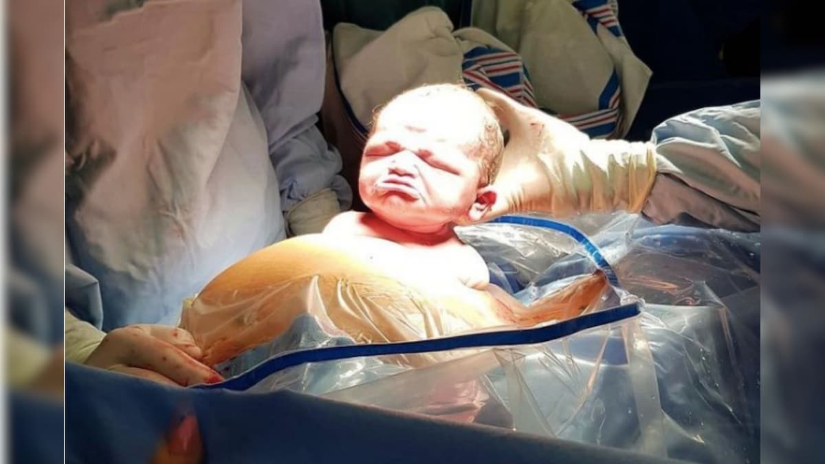 'Incredible Sulk': New Mommy has Hilarious Reaction as Baby Emerges with a Scowl from Womb