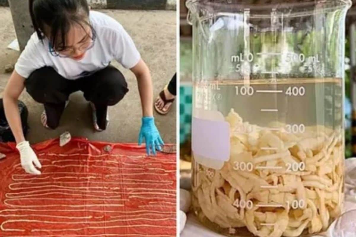 59-feet-long-tapeworm-removed-from-thai-man-s-rectum-pics-go-viral