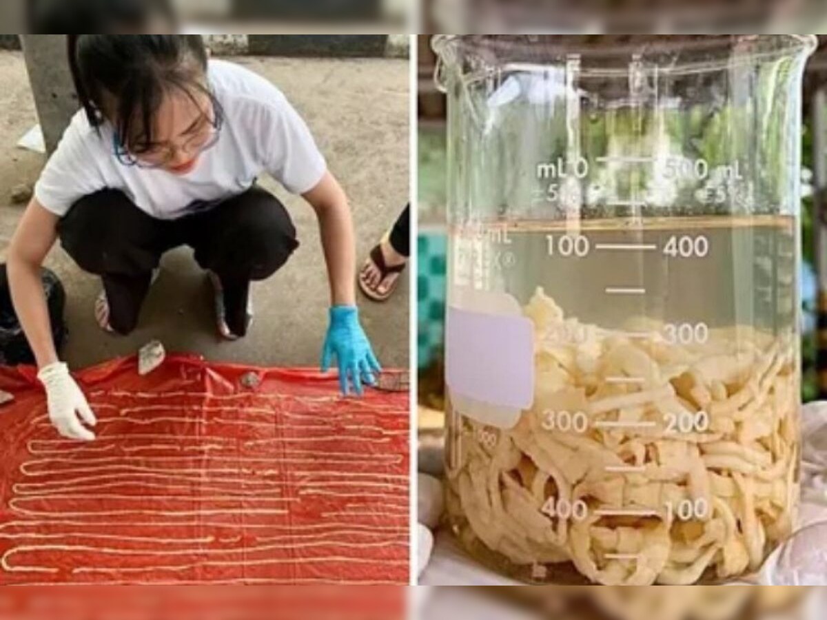 59 Feet Long Tapeworm Removed From Thai Man S Rectum Pics Go Viral