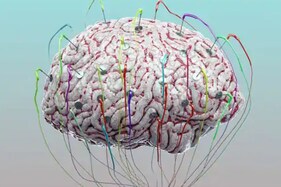 IIT Madras, MIT Scientists Develop Brain Tissues Using 3D Printed Bioreactor