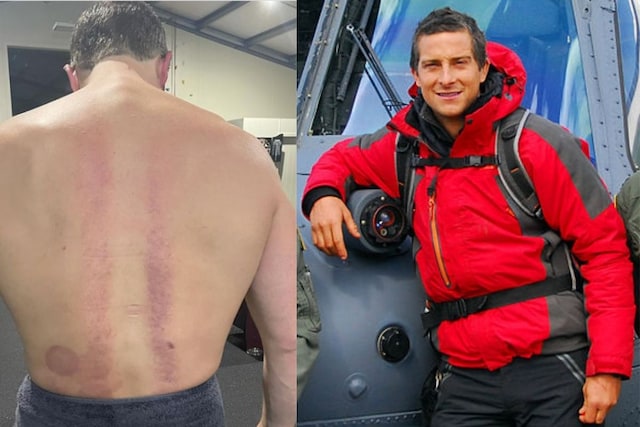 Bear Grylls Says He is in Pain Every Day After Breaking His Back in Accident 25 Years Ago