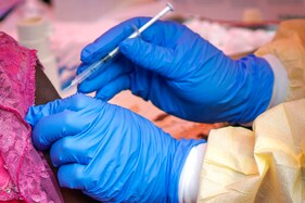 Man's Ebola Relapse Spawned Dozens Of New Cases In Africa