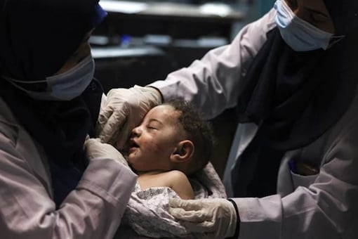 A nurse holds five-month-old Omar al-Hadidi who was pulled alive from under the rubble of a home hit by an Israeli air strike in Gaza while his mother and four siblings were killed MAHMUD HAMS AFP