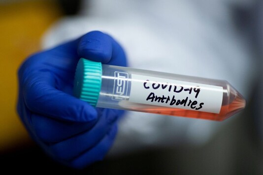 COVID-19 Antibody 