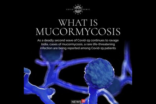 Busting Myth Fungal Disease Reported During Covid 19 Second Wave Is Mucormycosis Not Black Fungus