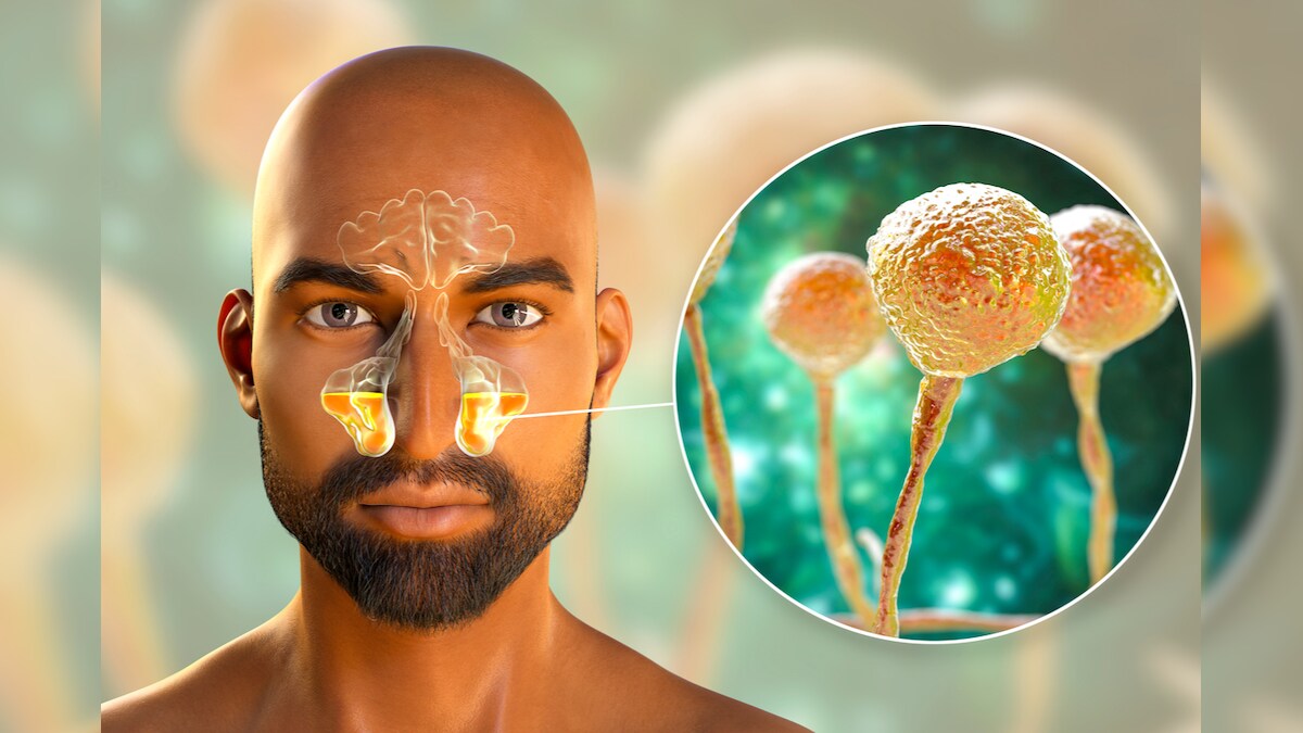 Explained Difference Between Black Fungus, White Fungus, Yellow Fungus