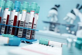 COVID-19: Different Types of Blood Tests and Their Significance