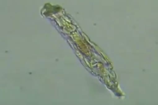 Russian scientists have found a microscopic organism called the bdelloid rotifer in the vast permafrost lands of northeastern Siberia. (Credit: REUTERS/Youtube)