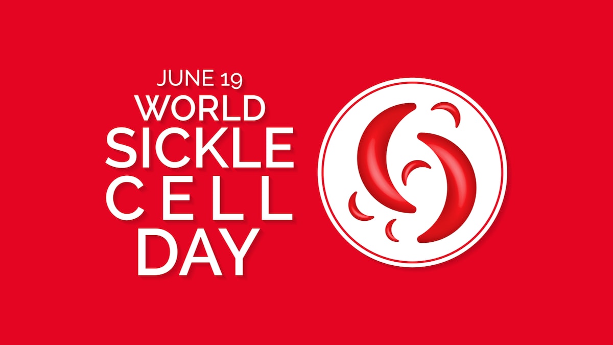 World Sickle Cell Day 2021 What is Sickle Cell Disease? Symptoms