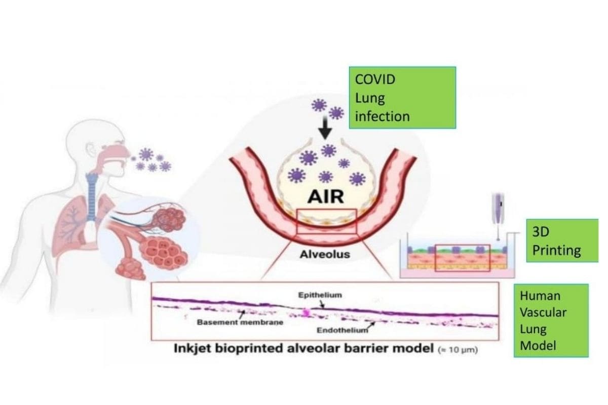 You are currently viewing Anti-Diabetic Medication Have Potential to Deal with Covid-19, Finds Hyderabad College Examine