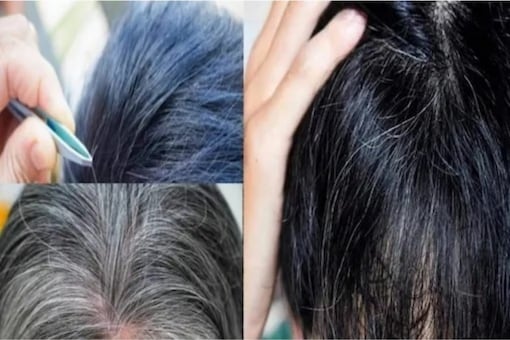 Treat Your Premature Grey Hair With These Home Remedies
