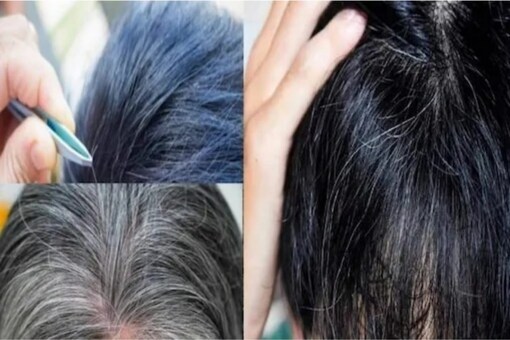 Treat Your Premature Grey Hair With These Home Remedies Treat Your Premature Grey Hair With These Home Remedies