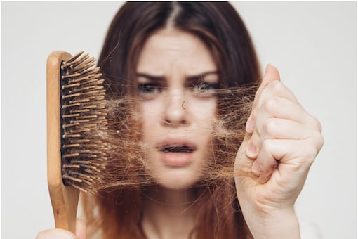 Rise in Hair-loss is New Post Covid Complications: Doctors Rise in Hair-loss is New Post Covid Complications: Doctors