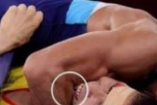 Actor Suniel Shetty expressed shocked over pictures of Indian wrestler Ravi Kumar Dahiya getting bit by his opponent Nurislam Sanayev during a Tokyo Olympics match.