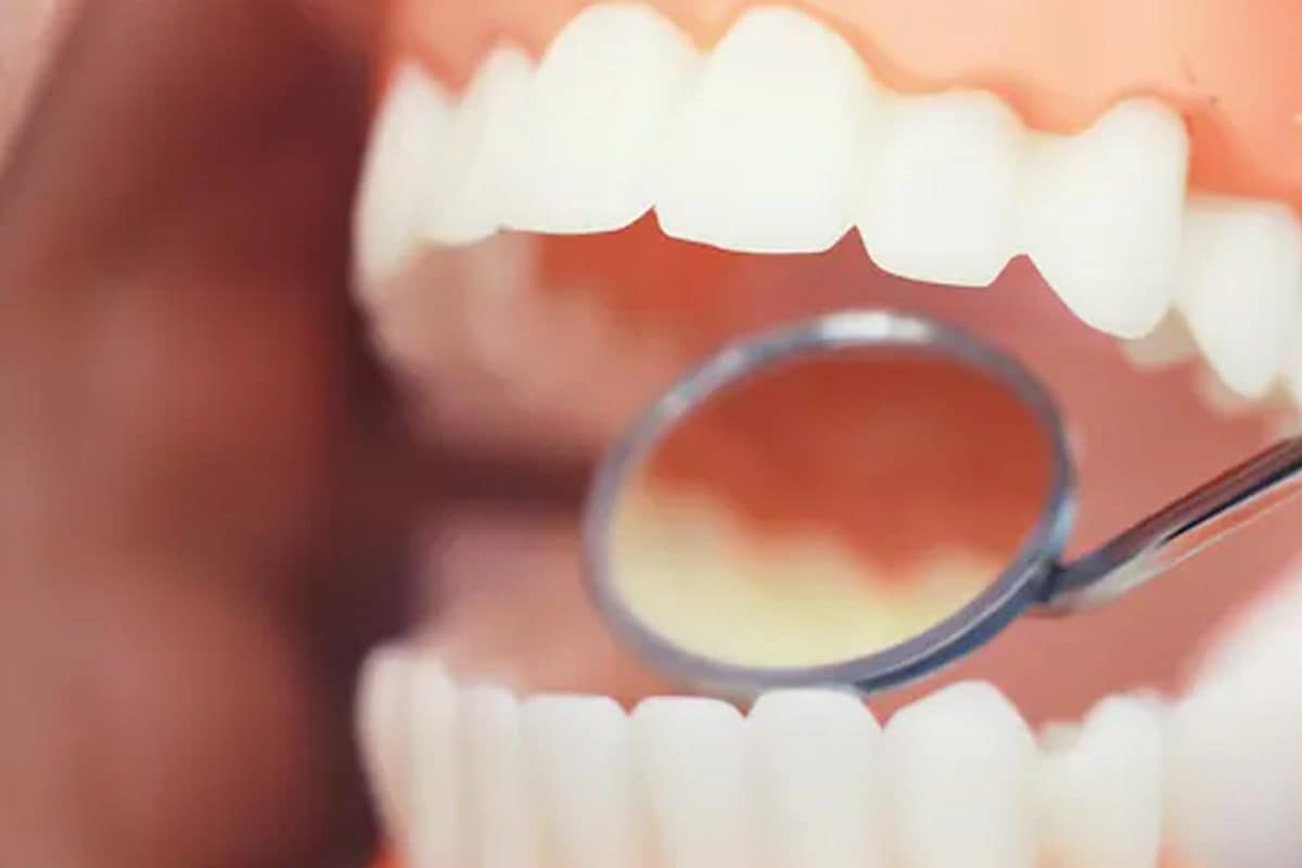 home remedies to get white teeth