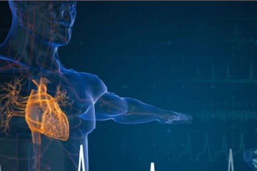 What is a Heart Attack? What Are Its Signs And Causes? What is a Heart Attack? What Are Its Signs And Causes?