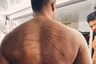 Vicky Kaushal Shares Picture of His Injured Back from 'Sardar Udham', Fans Shower the Post with Love