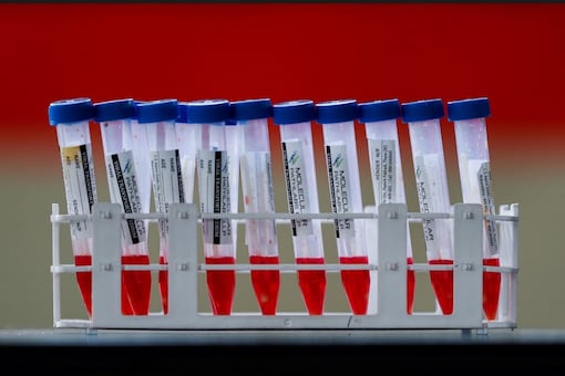 Swab samples are seen during a rapid antigen testing campaign. (Image: Reuters)
