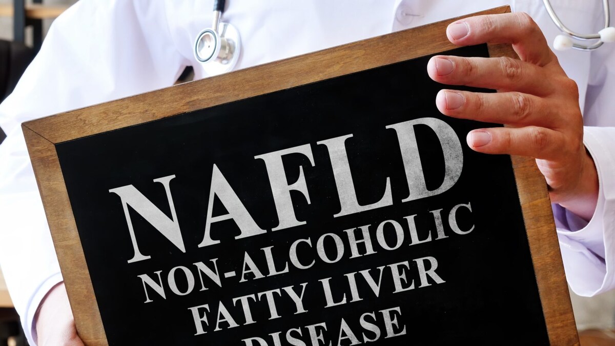 This Liver Disease Can Hit You even if You Don’t Drink Alcohol