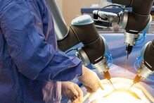 AIIMS Jodhpur Uses Fully Robotic Surgery to Fix Patient's Food Pipe