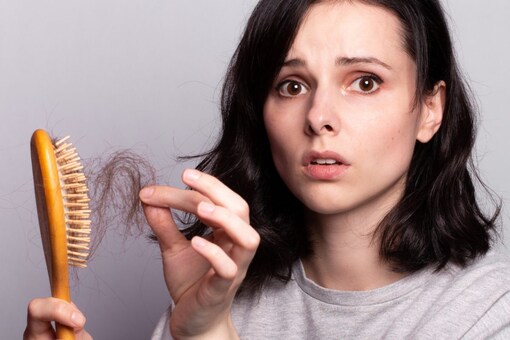 Winter Hair Care Tips: Home Remedies to Deal With Oily Hair Winter Hair Care Tips: Home Remedies to Deal With Oily Hair