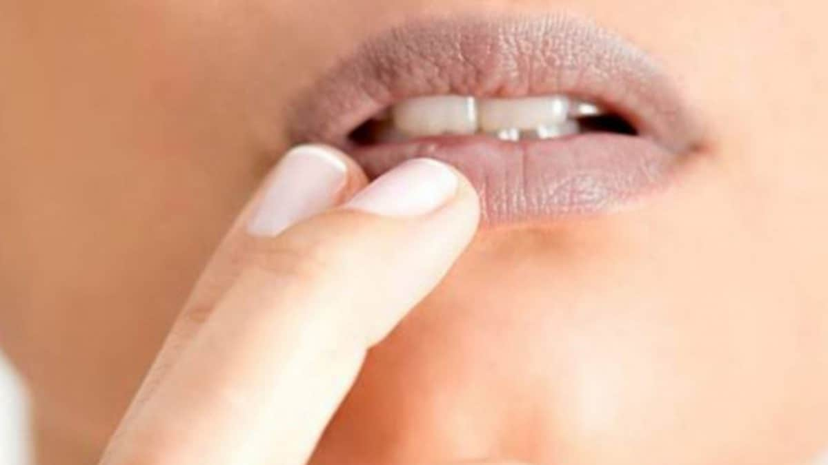 5 Experts Ways to Soothe Your Dry Lips and Eyelids in Winters