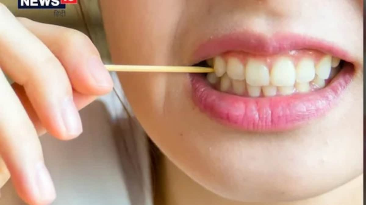 These Home Remedies can Help Cure Bleeding Gums