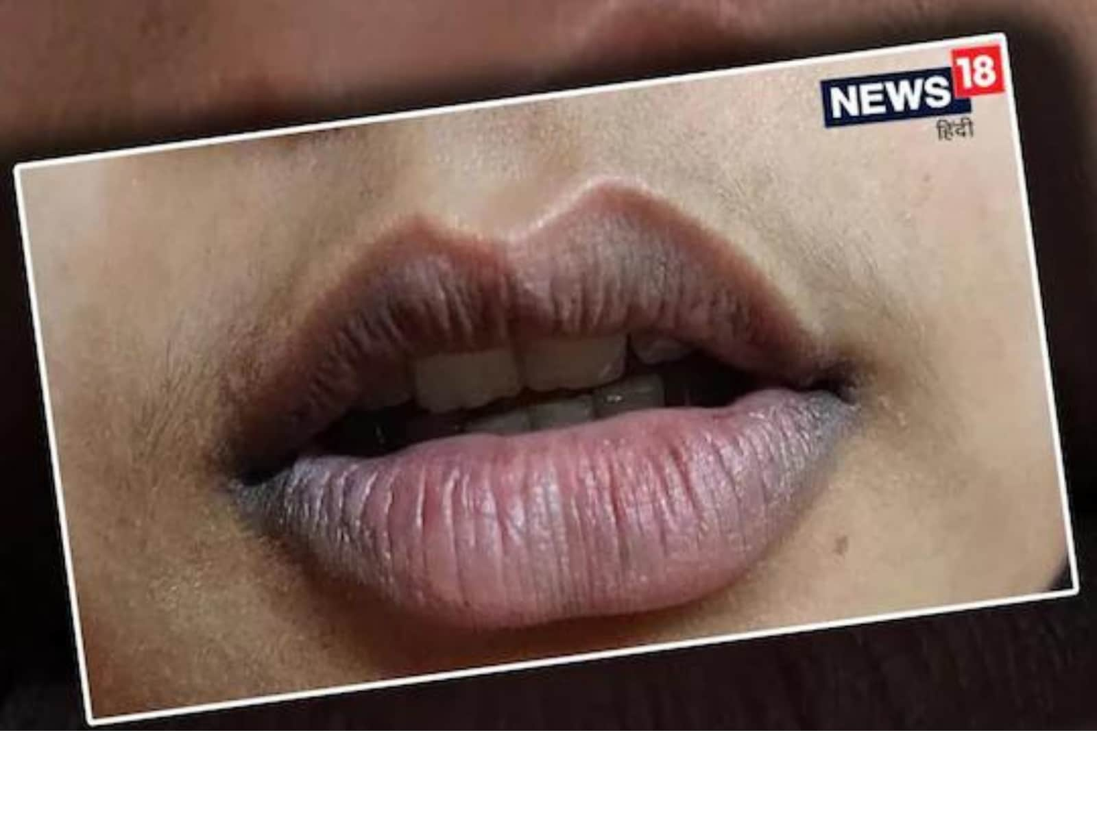 why-does-smoking-turn-lips-dark-infoupdate