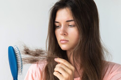 Hair loss is a problem that many people suffer in their lifetime (Image: Shutterstock)