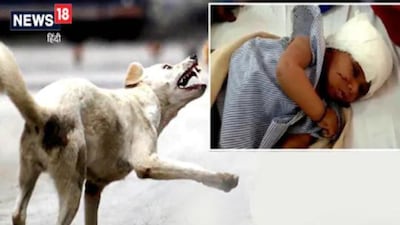 In Madhya Pradesh's Ujjain, One-Year-Old Girl Bitten By Stray Dogs ...