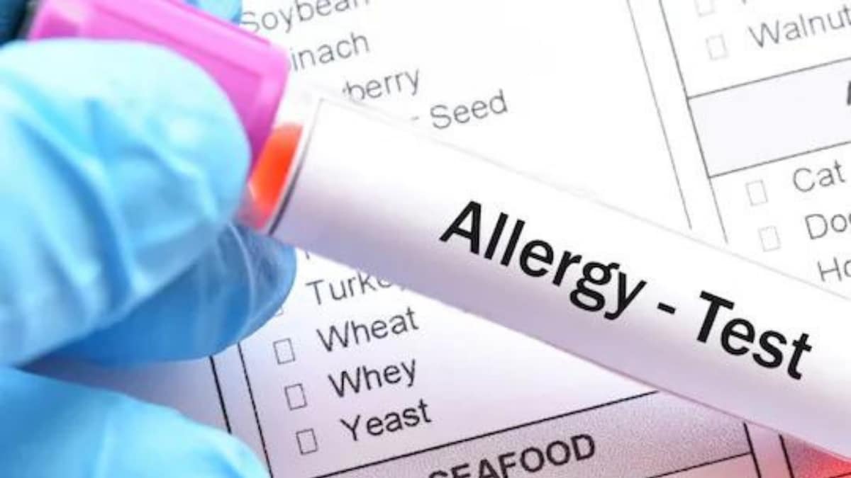 A New Study Can Now Predict The Success of Treatment For Allergies