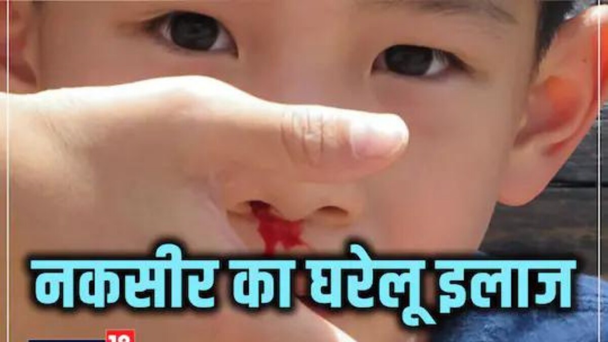 Vinegar to Steam, Easy Hacks to Prevent Nose Bleeding in Summers News18