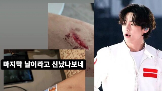 BTS: Kim Taehyung Gets Bruises On Last Day Of PTD Las Vegas Concert
