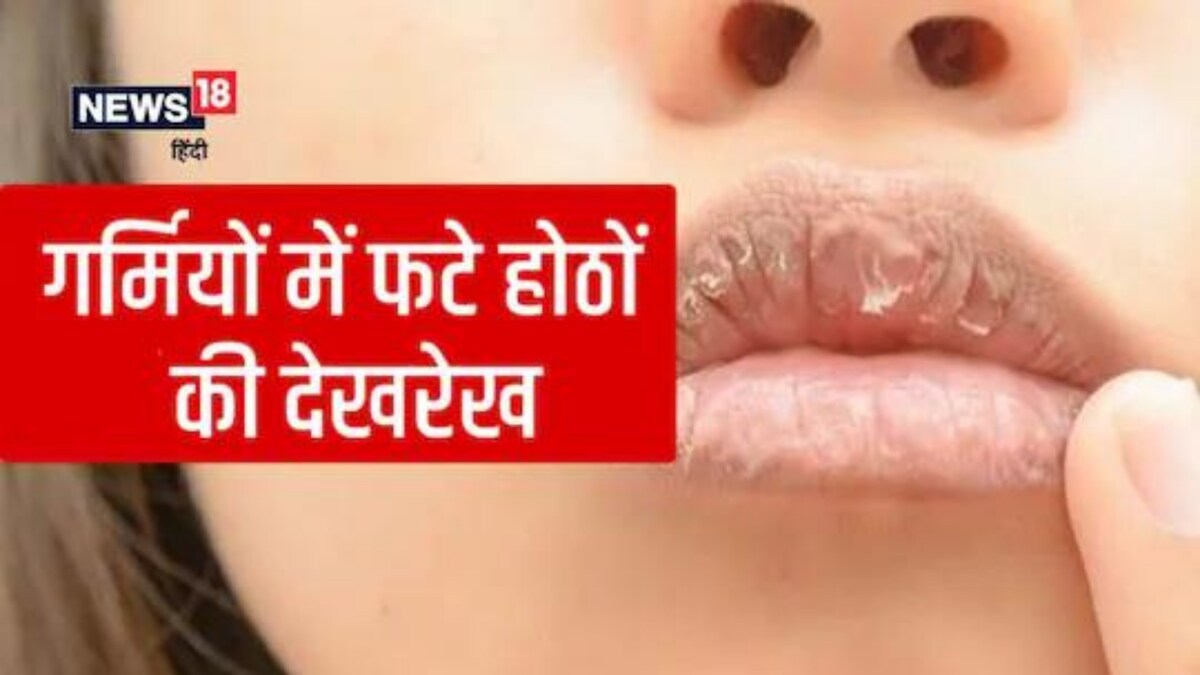 Home Remedies on How To Heal Chapped Lips