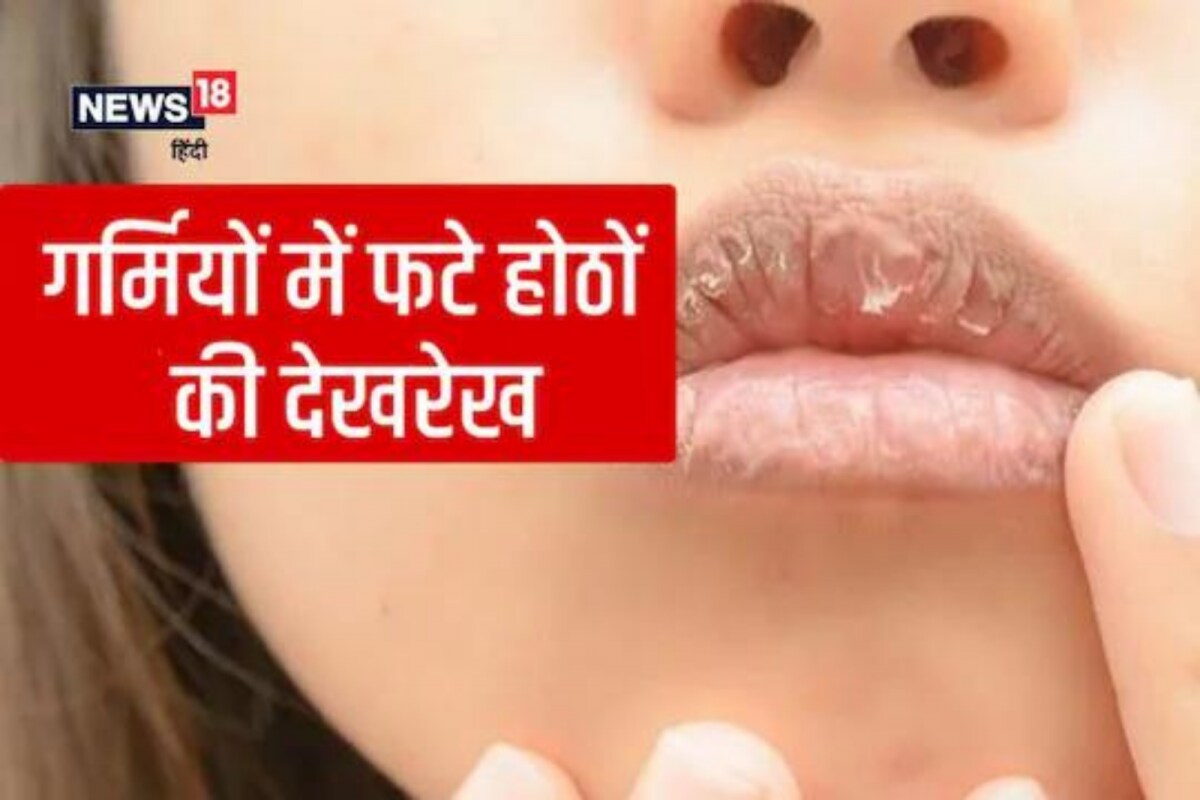 Why Lips Chapped In Summer